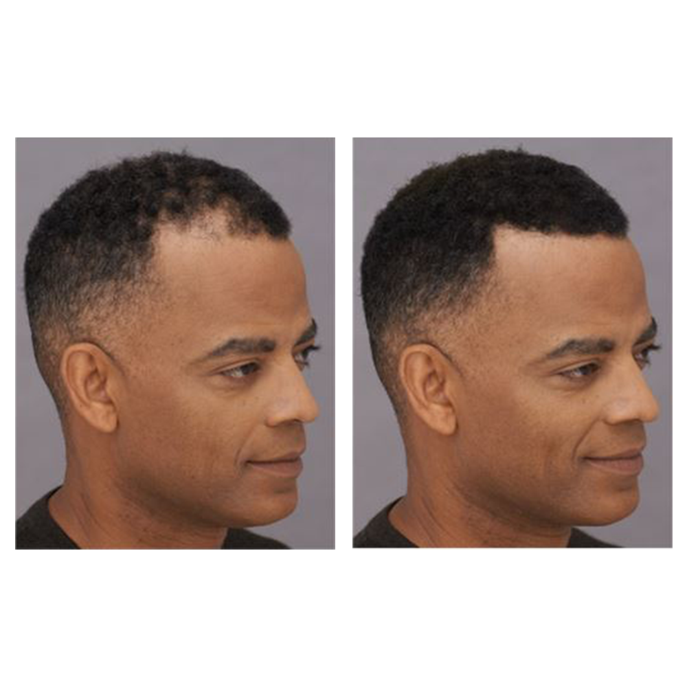 Nyuzi Nyeusi za Kujenga Nywele za Sevich