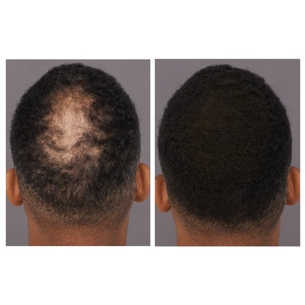 Nyuzi Nyeusi za Kujenga Nywele za Sevich